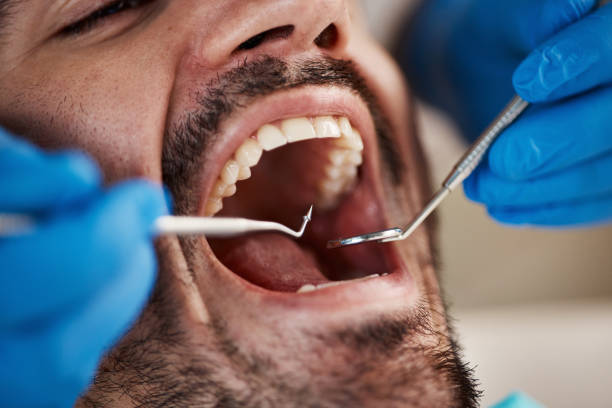 Best Emergency Dentist for Special Needs Patients in Northeast Ithaca, NY