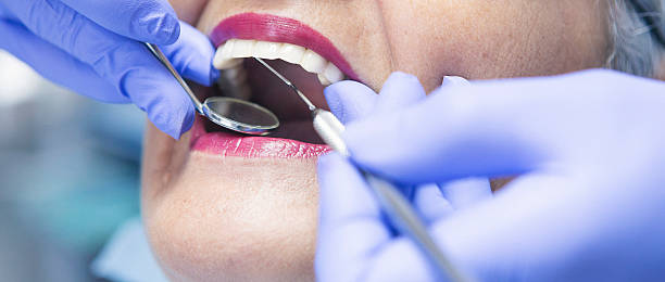 Best Emergency Dentist for Knocked-Out Tooth in Northeast Ithaca, NY